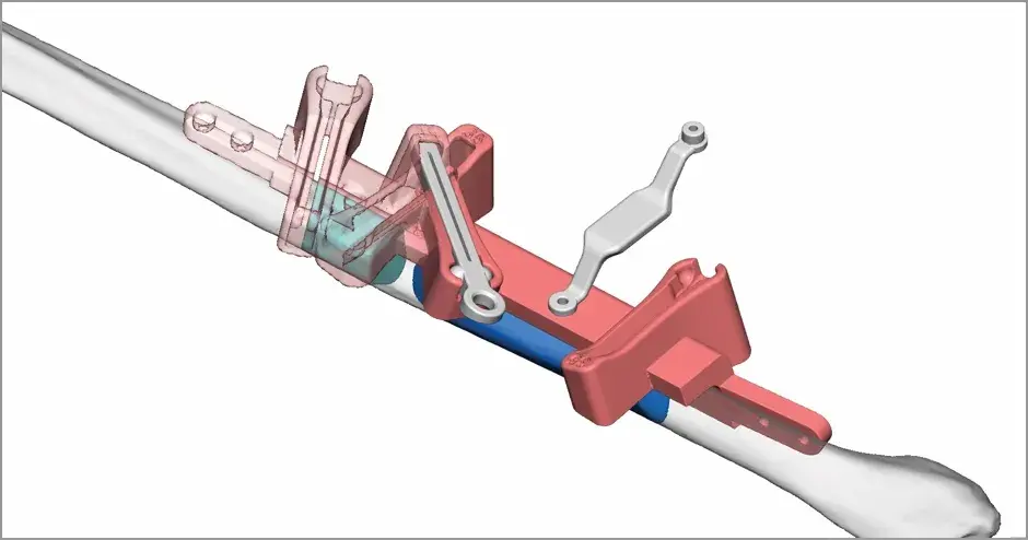 VSP - Planificación quirúrgica virtual