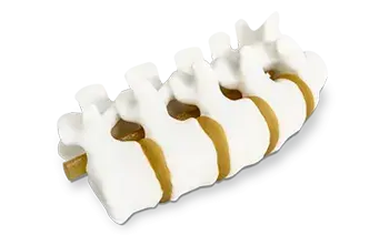 modelo anatómico de columna impresa en 3D de 3D Systems