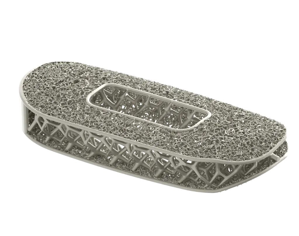 Implante espinal optimizado de NuVasive, producido mediante impresión 3D
