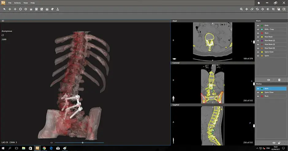 Dicom to Print D2P Software