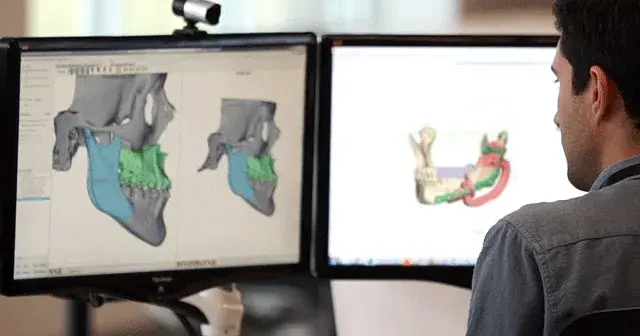 3d-systems-healthcare-vsp-cmf-planning