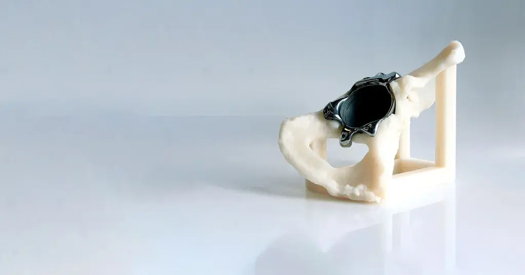 A hip cup made from 3D printing technology