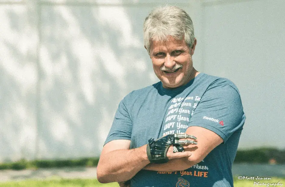 Jeff Soelberg usando su protésico parcial de mano por Point Designs