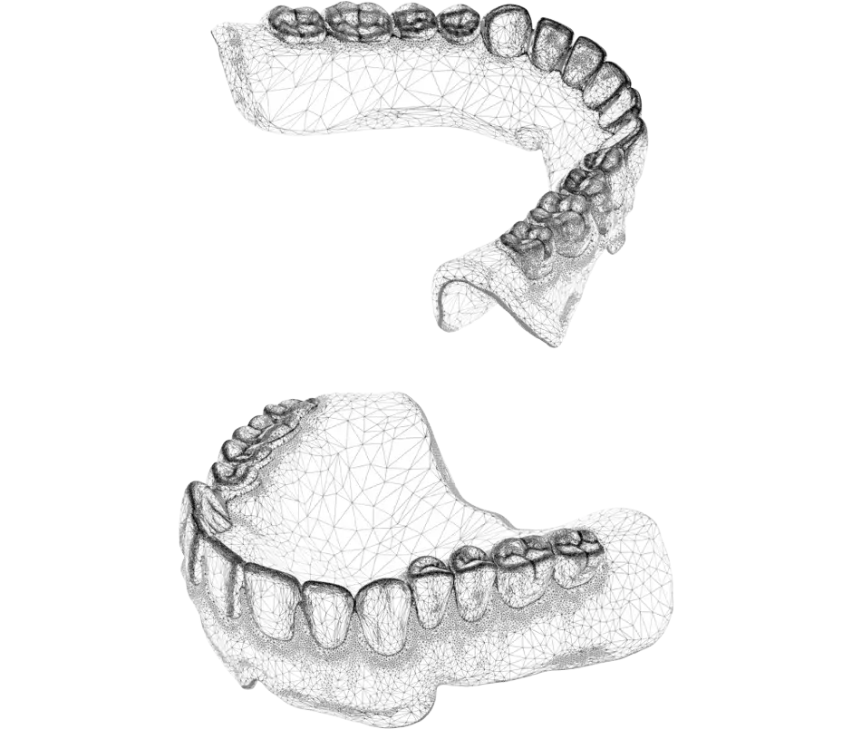 Archivo CAD de producción NextDent