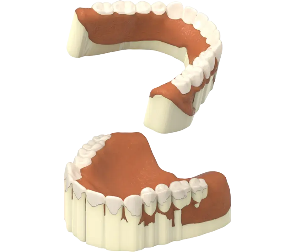 NextDent producción eliminar asistencia