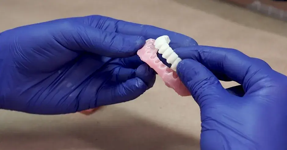 Un dentista sosteniendo prótesis dentales impresas en 3D