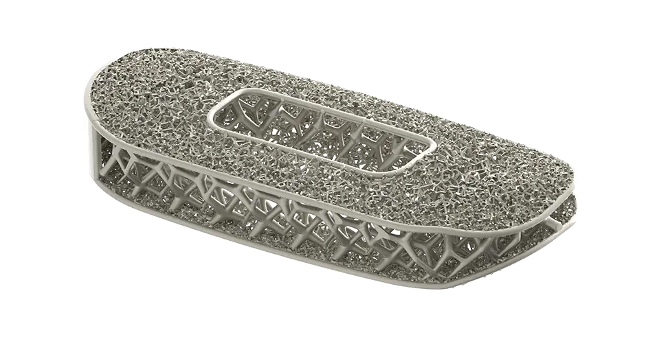 Implante espinal optimizado de NuVasive, producido mediante impresión 3D 