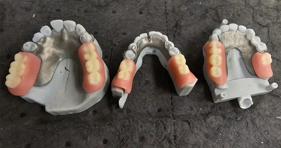 Dentaduras postizas impresas en 3D